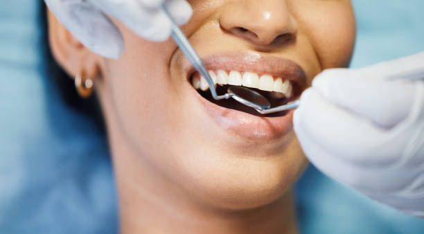 Professional Emergency Dental Service in SD